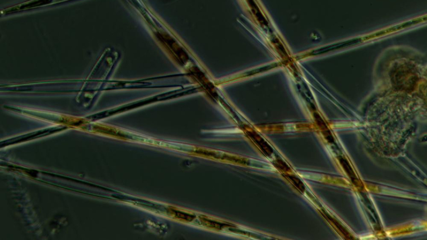 A close-up of Pseudo-nitzchia, a common a common type of phytoplankton. Sometimes, Pseudo-nitzchia blooms may produce domoic acid, a neurotoxin that can cause amnesiac shellfish poisoning.