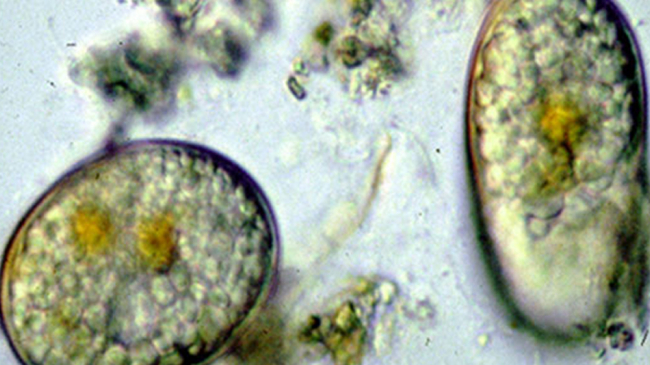 Seed-like cysts of the harmful alga Alexandrium fundyense.