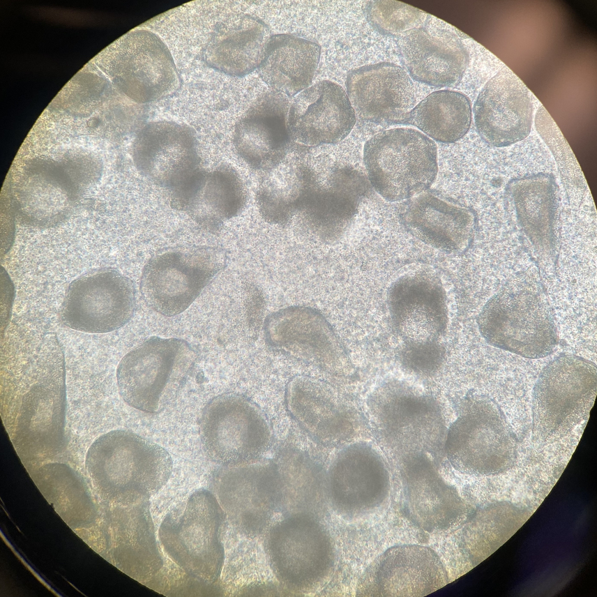 A photo taken through a microscope eye piece. The sample consists of innumerable small dots, with several larger irregular circles and ovals within them.